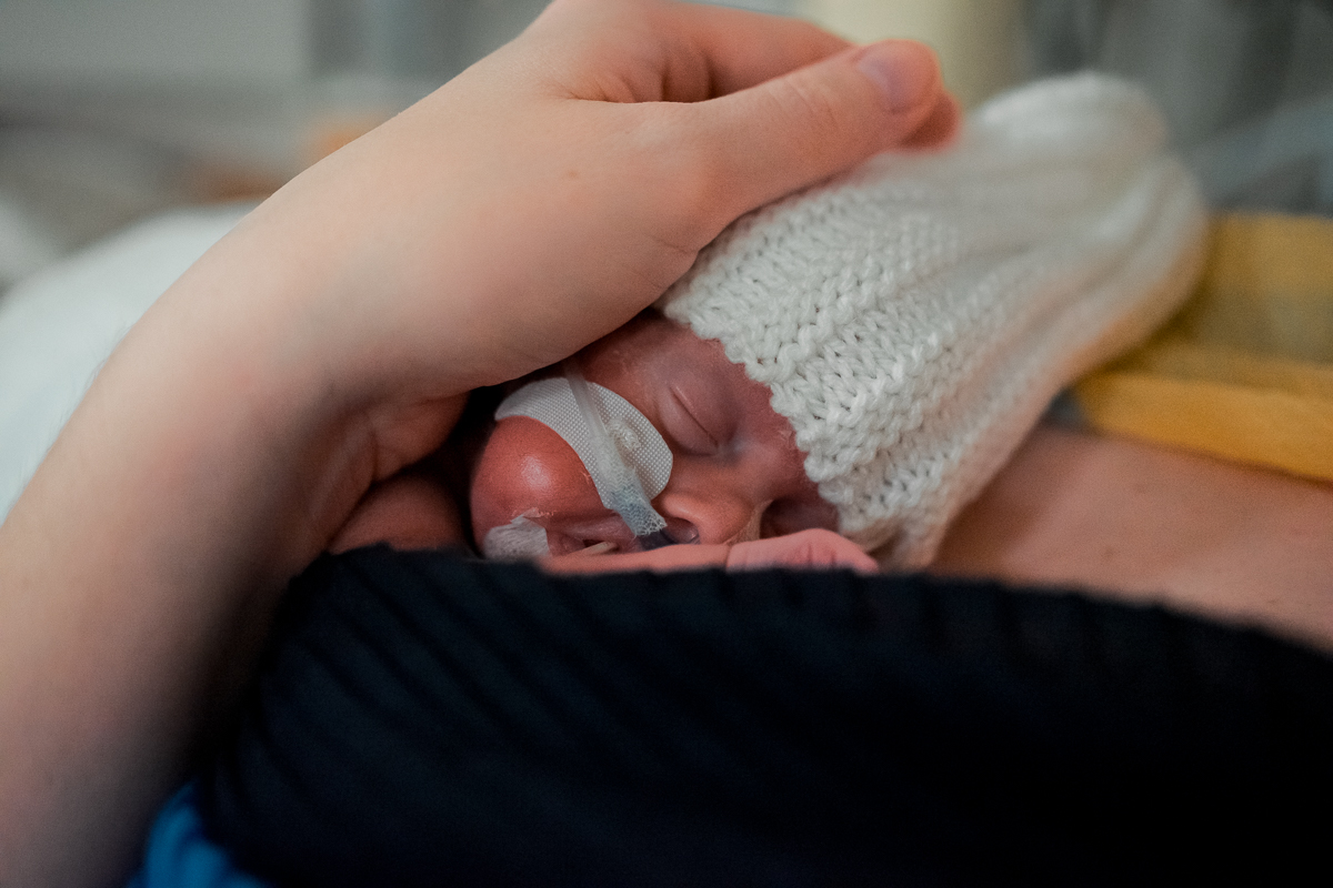 A hand gently touching the head of a premature baby wearing a hat.